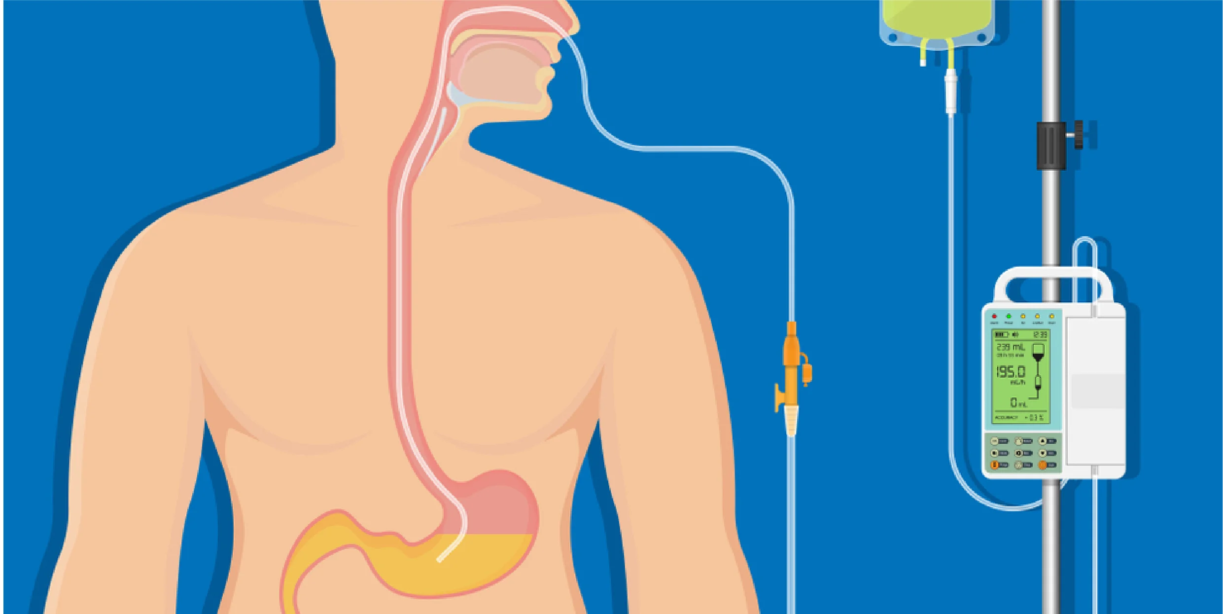 Gastroenterology Hospital in Jaipur, India | BMCHRC
