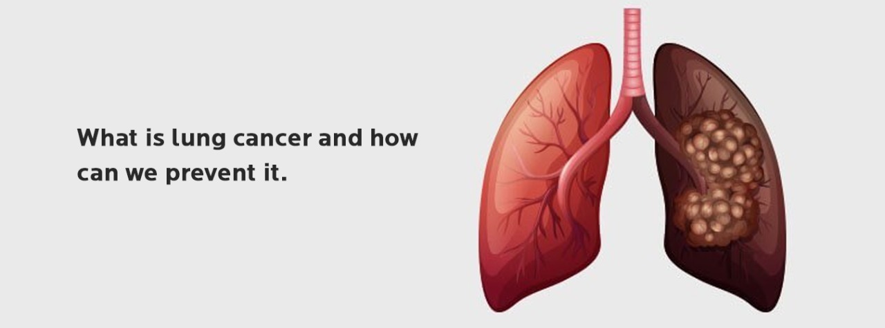 What is lung cancer and how can we prevent it